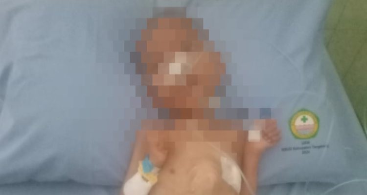 Miris Banget ! Bocah Gizi Buruk di Parungpanjang Meninggal, Tak Terdaftar BPJS PBI