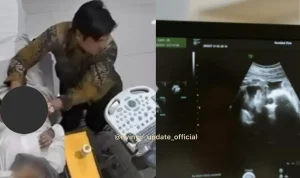 Dokter Kandungan di Garut Cabuli Pasien Saat USG, Berikut Kronologinya